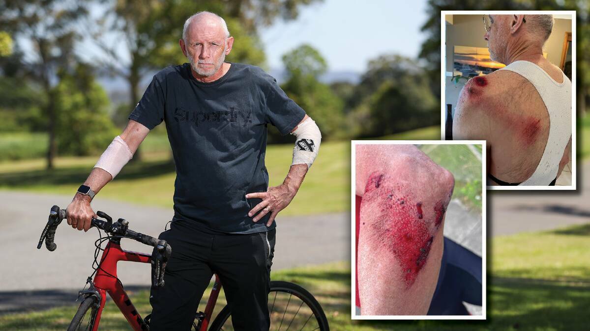 Gary Shaw pictured after he was knocked off his bike near Harvey Norman in Warrawong on November 30. Picture by Adam McLean, insets supplied
