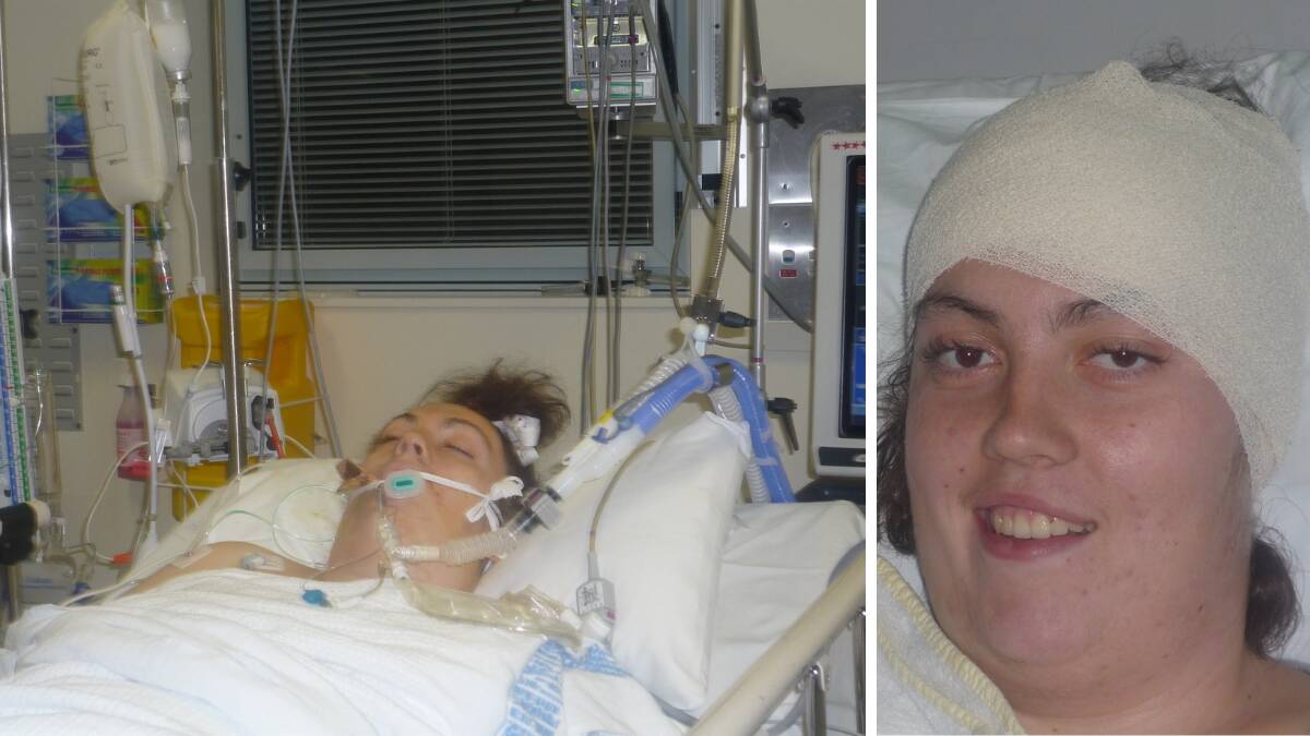 Beth Doggett after the first of three brain surgeries. Picture supplied.
