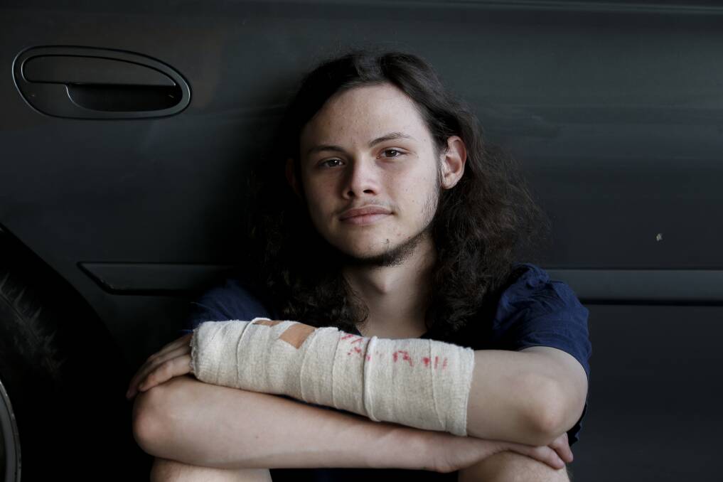 Bailey Wilke, 19, said there was no blood and gore after his Holden Commodore crushed his arm when the jack broke changing a tyre, but the intense pain sent him into shock. Picture by Anna Warr.