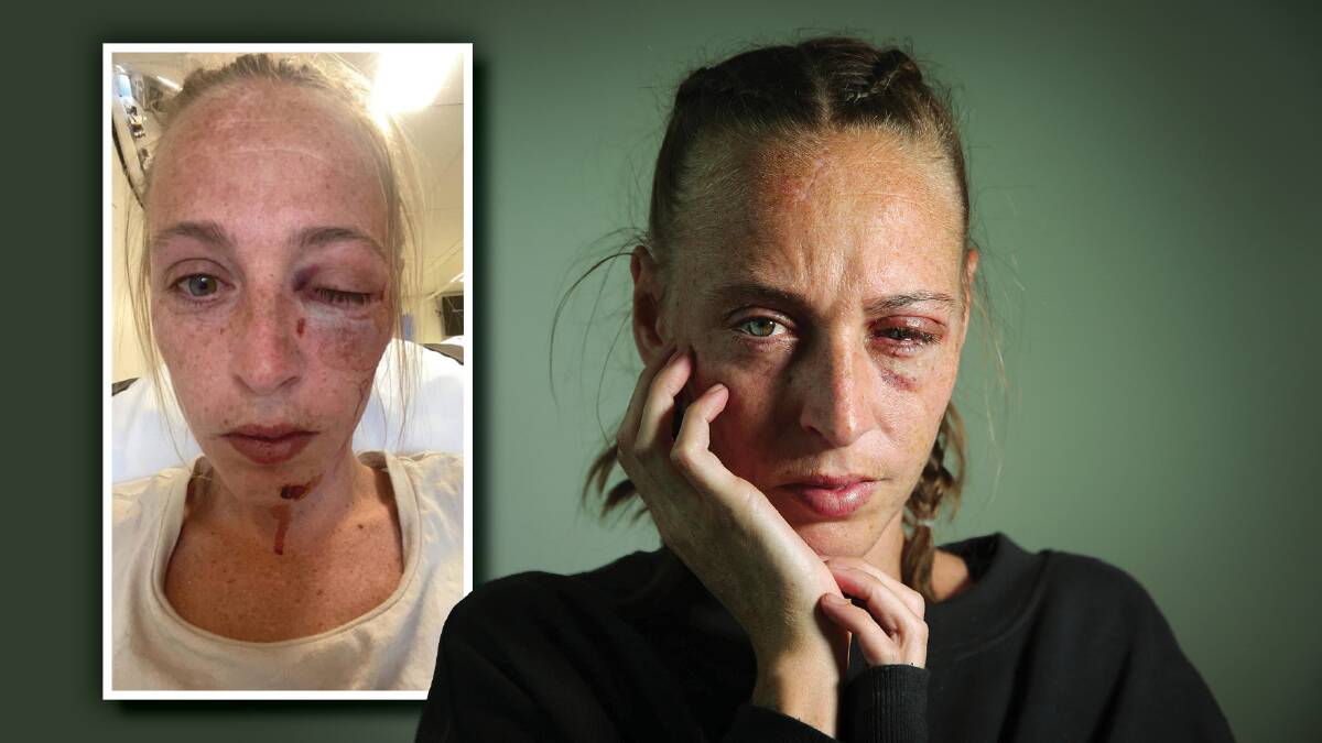 A long, costly road ahead for Dapto mum blinded in alleged playground attack