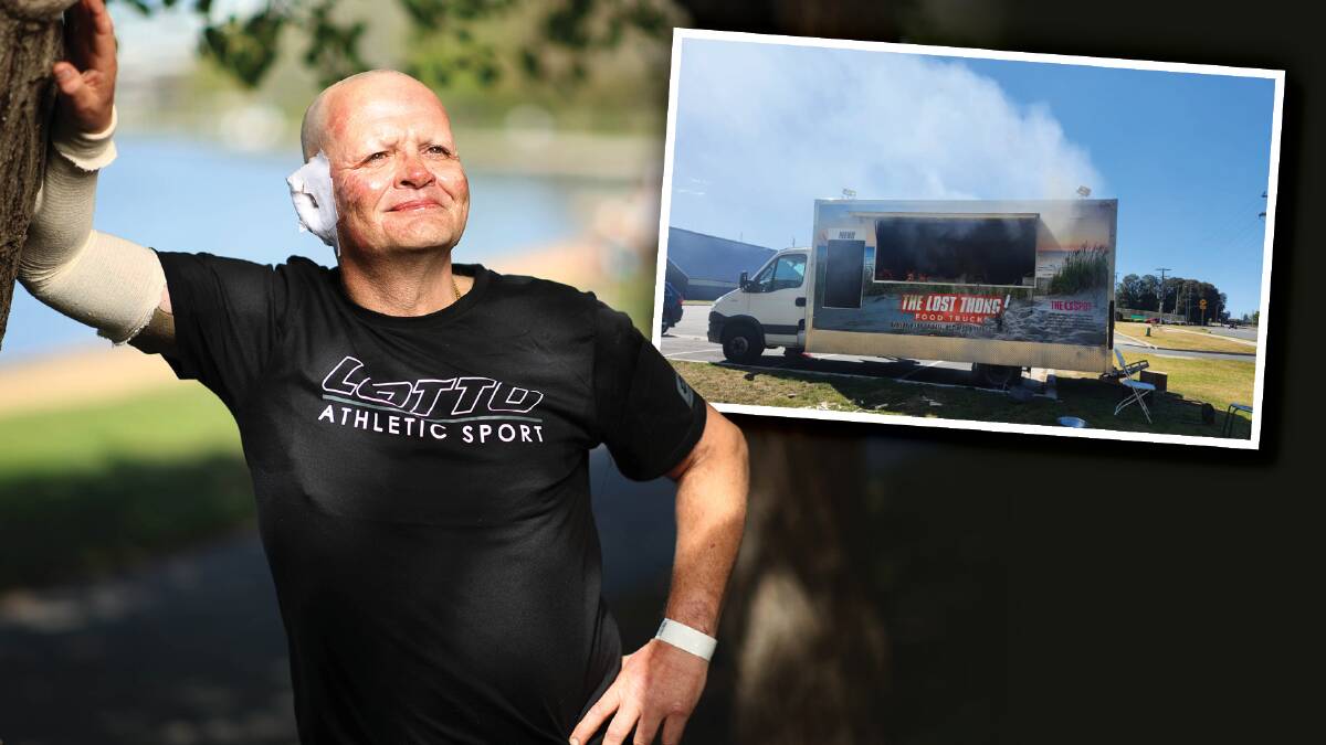 Andrew Dale in Canberra on Wednesday after surviving an explosion in his food truck at Batemans Bay last weekend. Picture by Gary Ramage